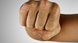 Ilustrasi Pemukulan yang dilakukan oleh Mantan Bupati Kepulauan Sula kepada Warga Fat Iba Husni Usia. (Rakyatmu)