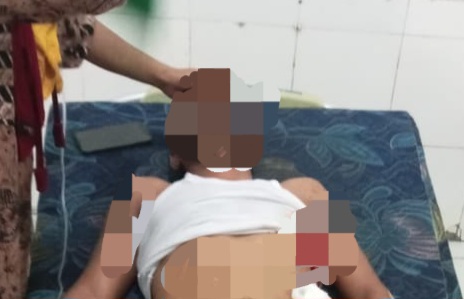 Korban Penikaman OTK Dilarikan ke RSUD Sanana. (Rakyatmu)