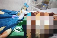 Korban Usai Menjalani Operasi Pembersihan Kulit Akibat Luka Bakar. (Rakyatmu)