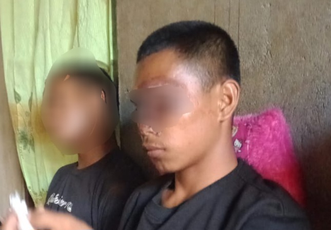 Korban Penganiayaan dan Pengeroyokan di Desa Kawasi, Kecamatan Obi, Kabupaten Halmahera Selatan. (Rakyatmu)